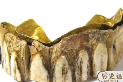 200年前黄金假牙是怎么回事