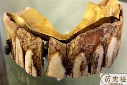 200年前黄金假牙是怎么回事