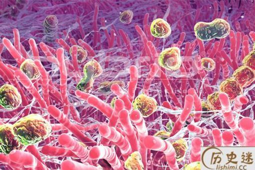 古人长背疮为什么会死