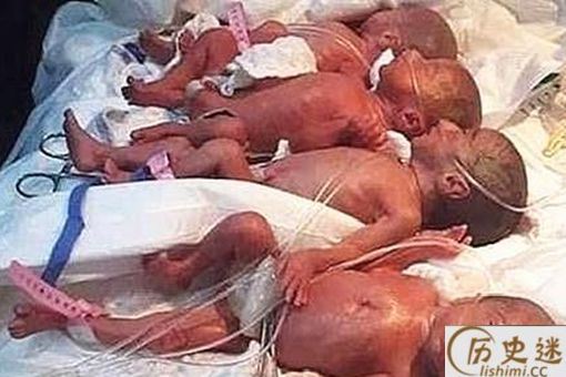 马里一产妇生九胞胎是真的吗