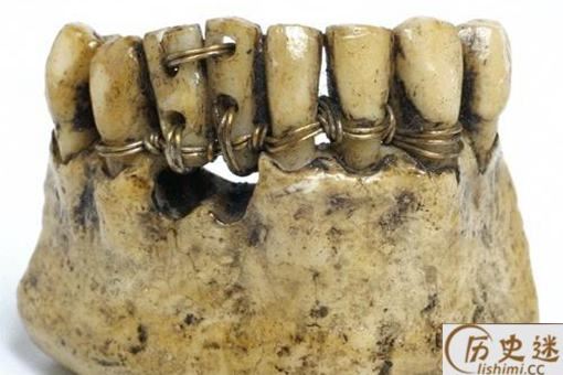 古代人的假牙使用什么做的