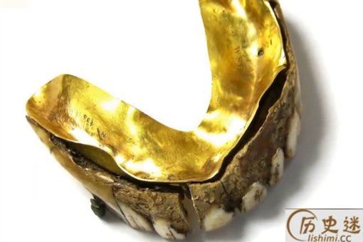 200年前黄金假牙是怎么回事