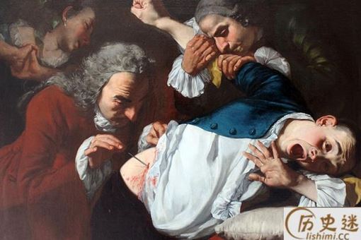 古代人得了阑尾炎会怎么办？