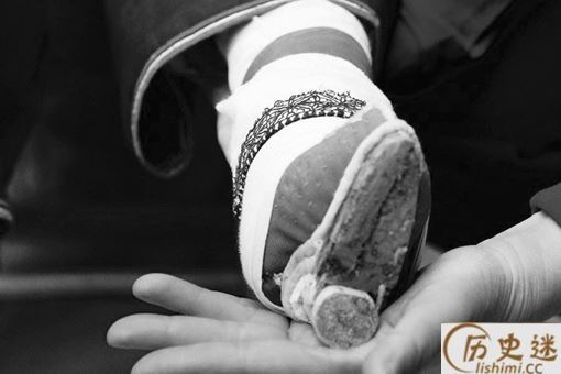 裹小脚是为了缩阴吗
